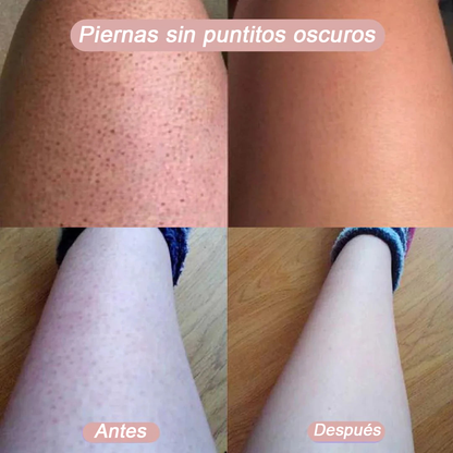 DepilPro